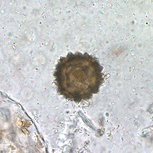 Case210_A.jpg