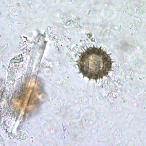 Case210_B.jpg