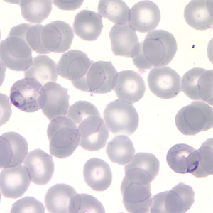 Case217_A.jpg