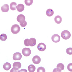 Case218_A.jpg