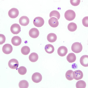Case218_C.jpg