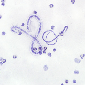 Case222_A.jpg
