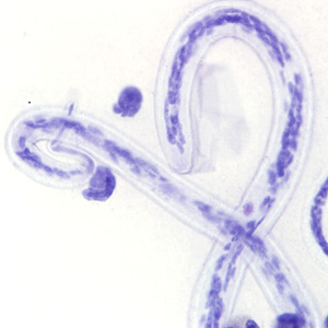 Case222_C.jpg