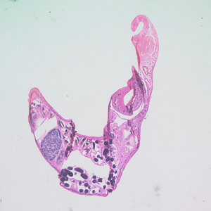 Case224_A.jpg