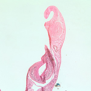 Case224_B.jpg