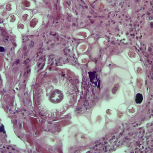 Case225_A.jpg