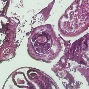 Case225_B.jpg