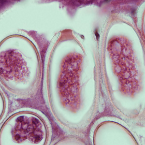 Case225_D.jpg
