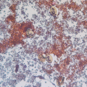 Case227_A.jpg