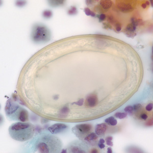 Case227_B.jpg