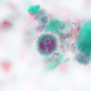 Case228_A.jpg