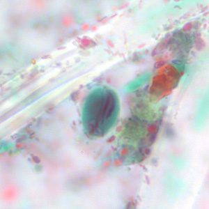 Case228_C.jpg