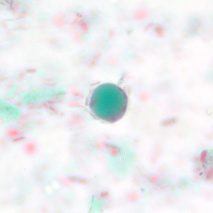 Case228_F.jpg