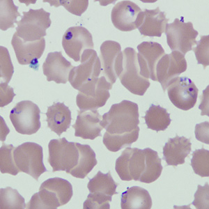 Case229_C.jpg