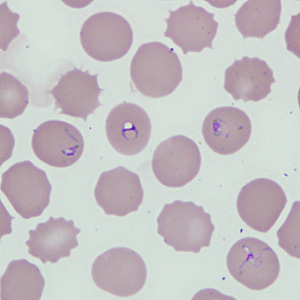 Case229_D.jpg