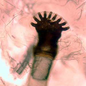 Case231_E.jpg
