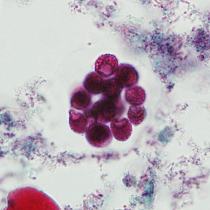 Case237_B.jpg