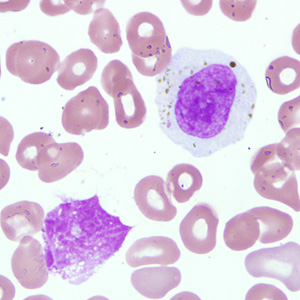 Case238_A.jpg