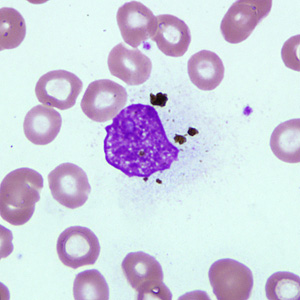 Case238_B.jpg