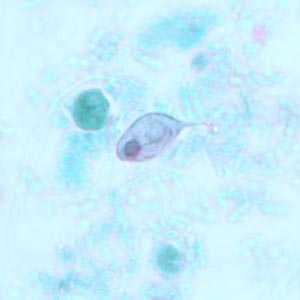 Case239_B.jpg