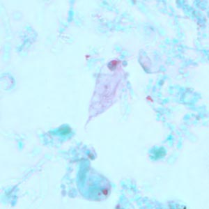 Case239_C.jpg