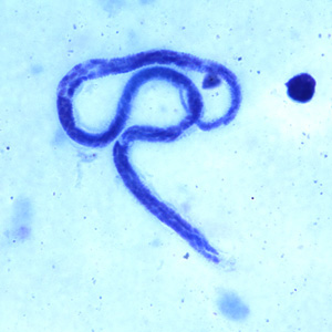 Case240_A.jpg