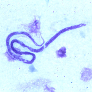 Case240_B.jpg