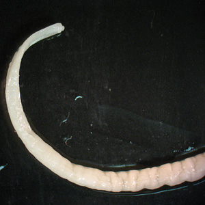 Case241_B.jpg