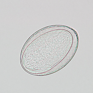 Case241_D.jpg