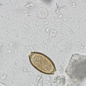 Case242_B.jpg
