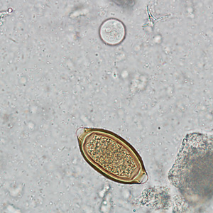 Case242_C.jpg
