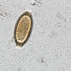 Case242_D.jpg