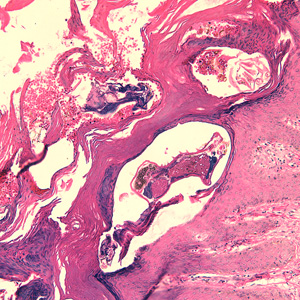 Case244_A.jpg