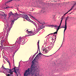 Case244_B.jpg