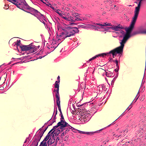Case244_D.jpg