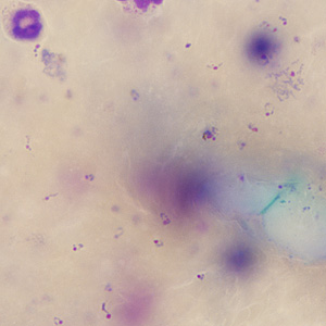 Case245_B.jpg