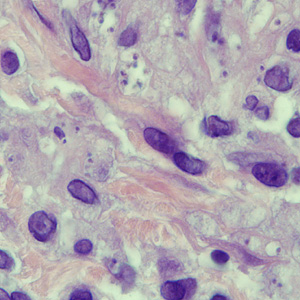 Case250_A.jpg