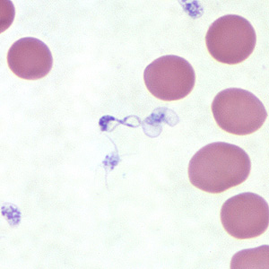 Case254_A.jpg