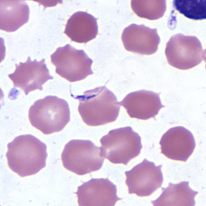 Case254_B.jpg