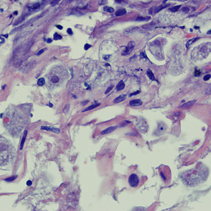 Case258_A.jpg