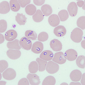 Case262_A.jpg