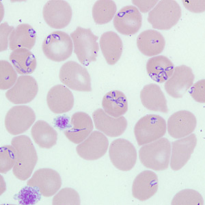 Case262_B.jpg