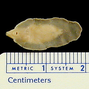 Case263_C.jpg