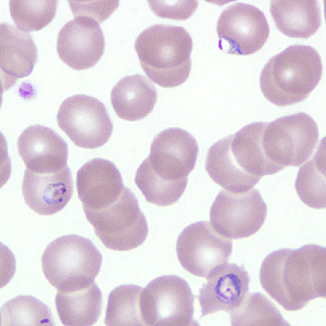 Case266_A.jpg