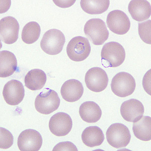 Case266_D.jpg