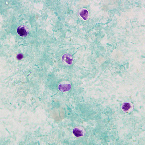 Case269_B.jpg