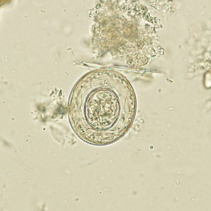 Case270_B.jpg