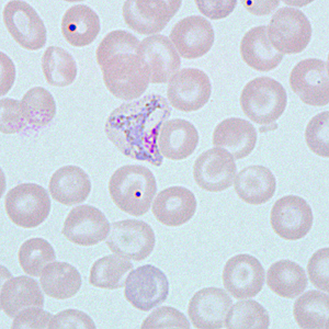 Case271_A.jpg