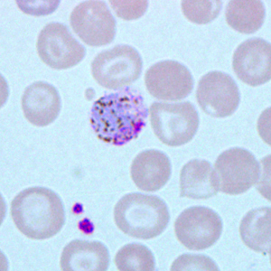 Case271_B.jpg