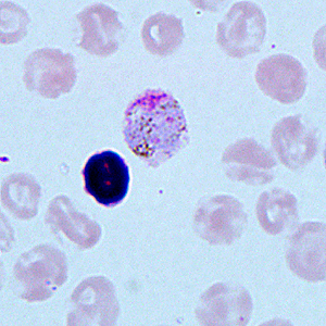 Case271_C.jpg